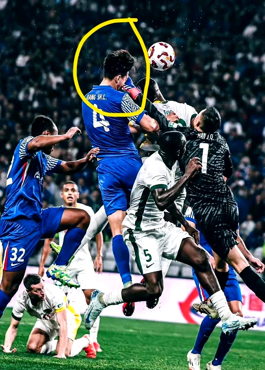 球员受伤无碍，继续为球队拼搏